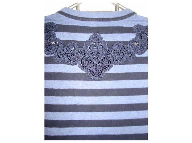 Karen Millen Abito a righe con inserti in pizzo Blu - vista 4