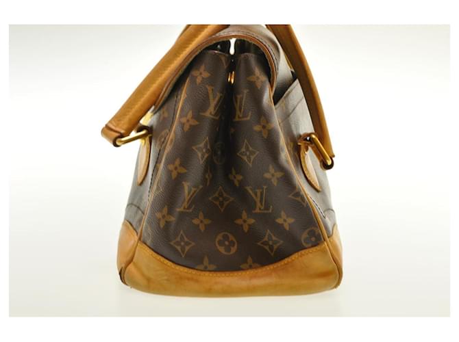 Louis Vuitton Beverly Castaño - vista 4