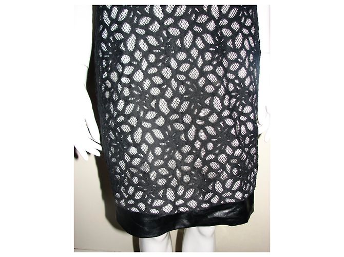 Diane Von Furstenberg DvF Tilda Shadow Spitzenkleid Schwarz Weiß - Ansicht 2