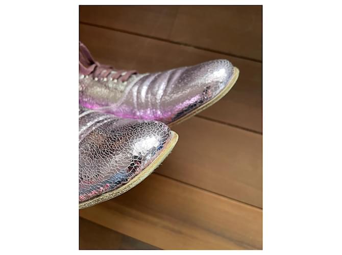 Derby Heschung in vernice rosa Metallico - vista 4