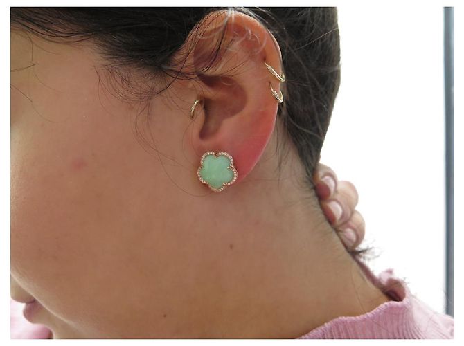 NEUN OHRRINGE PASQUALE BRUNI GOOD TONE ROTGOLD CHRYSOPRASE DIAMANT Golden - Ansicht 9