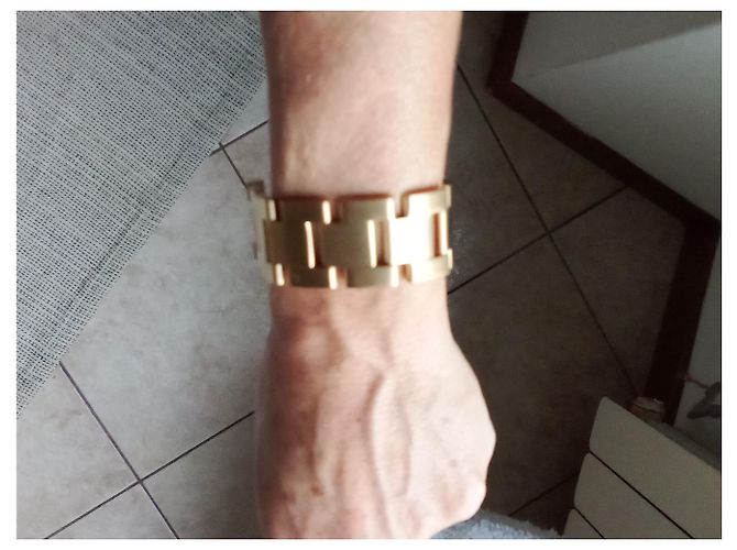 Victoria Beckham Bracciale gourmet - vista 6