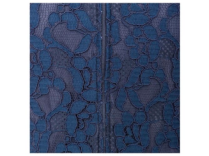 Spitzenkleid Dolce & Gabbana - Ansicht 9