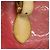 Saco Tote Louis Vuitton Vernis Brentwood - vista 12